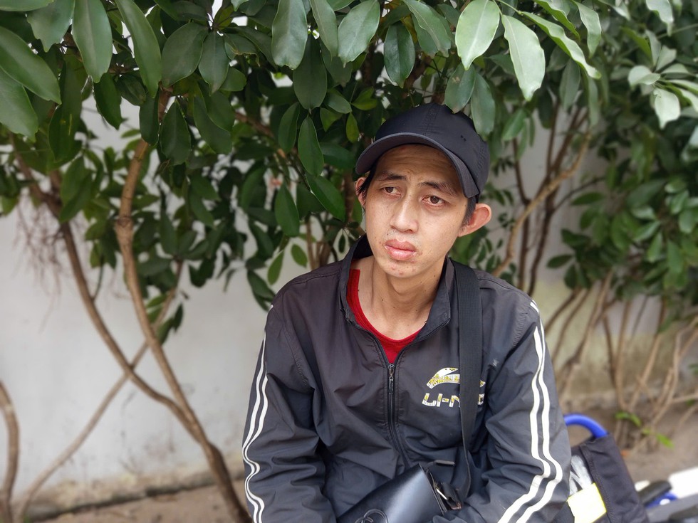 Chồng t&igrave;m c&aacute;ch cứu vợ vi&ecirc;m m&agrave;ng n&atilde;o ở Chợ Rẫy, t&uacute;i kh&ocirc;ng c&oacute; nổi 500.000 đồng- Ảnh 1.