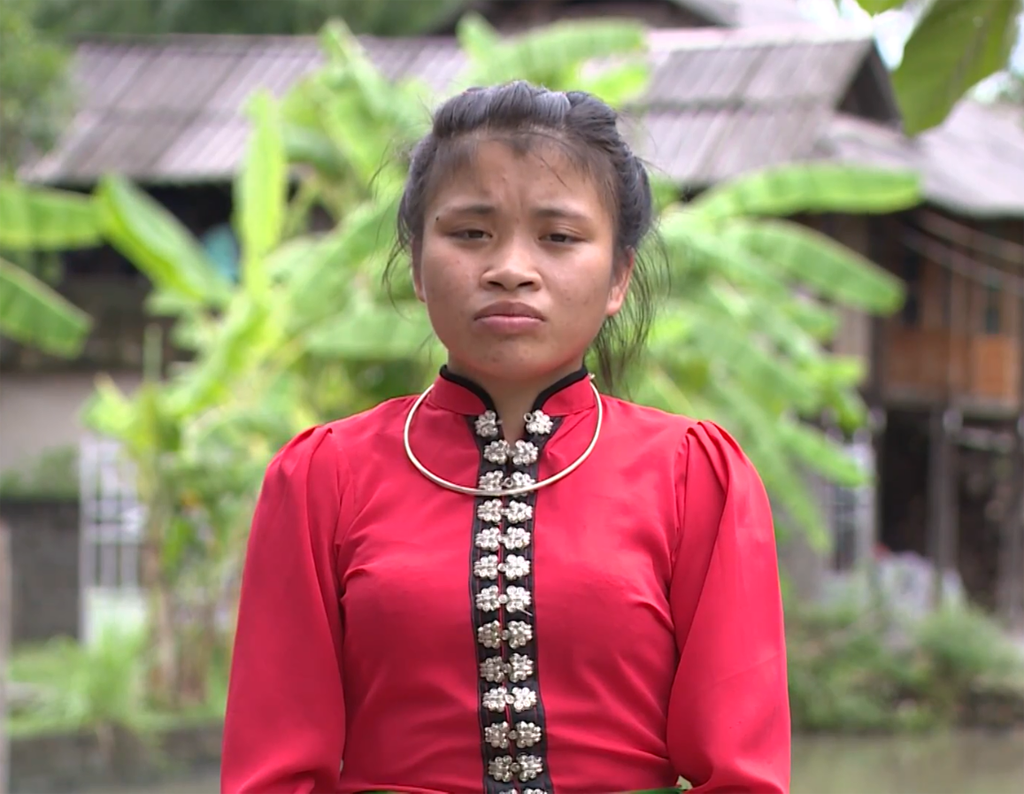 Cô gái dân tộc Thái không nhận ra chính mình sau đại phẫu thẩm mỹ