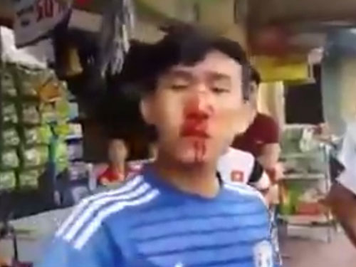 Clip “CSCĐ đánh người chảy máu mũi”: “Chúng tôi đang thanh tra, làm nghiêm và sẽ công khai kết quả”