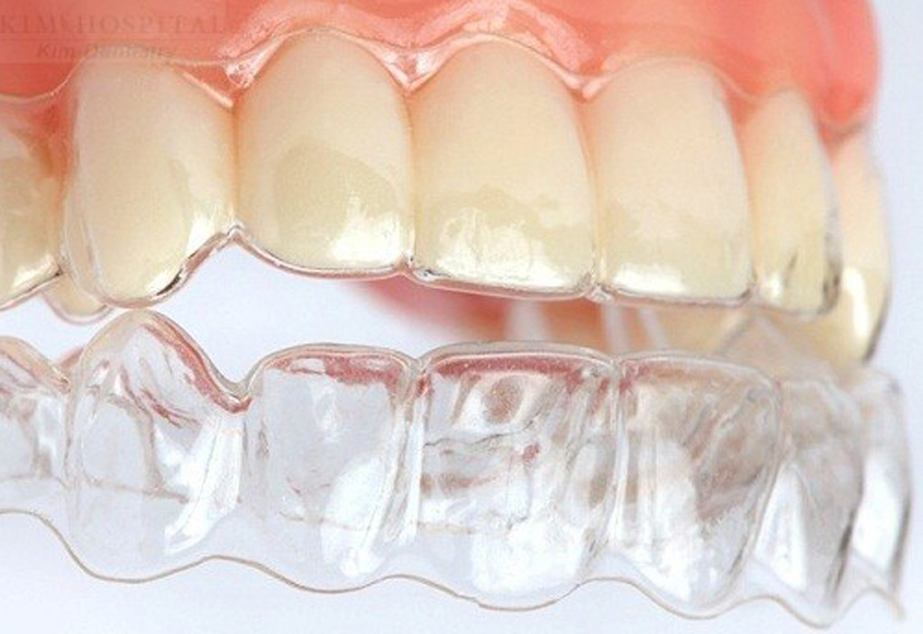 Hội thảo niềng răng không mắc cài 3D từ Nha khoa Đăng Lưu 5