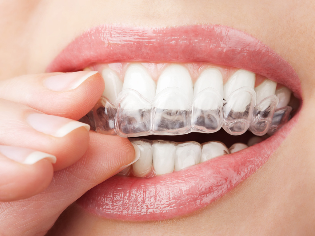 Bọc răng sứ lợi hại ra sao? 2