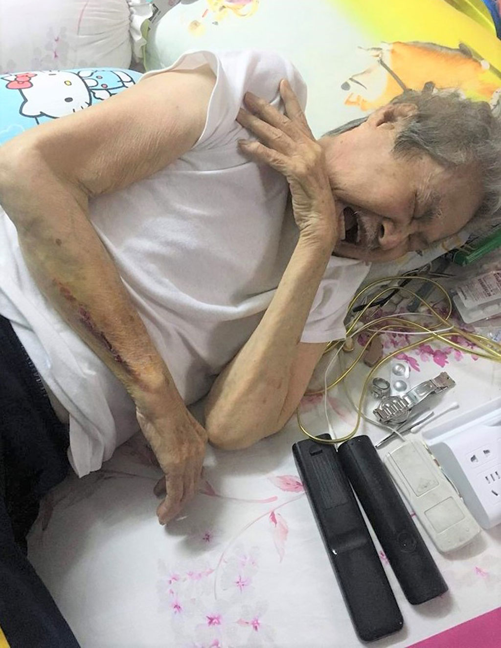 Ở tuổi 91, quái kiệt Tòng Sơn không có tiền chữa bệnh1