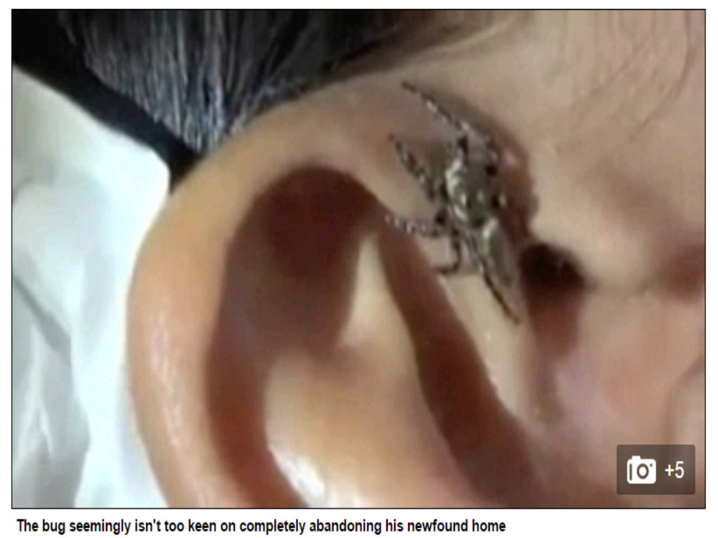 Kinh hoàng con nhện chui vào lỗ tai