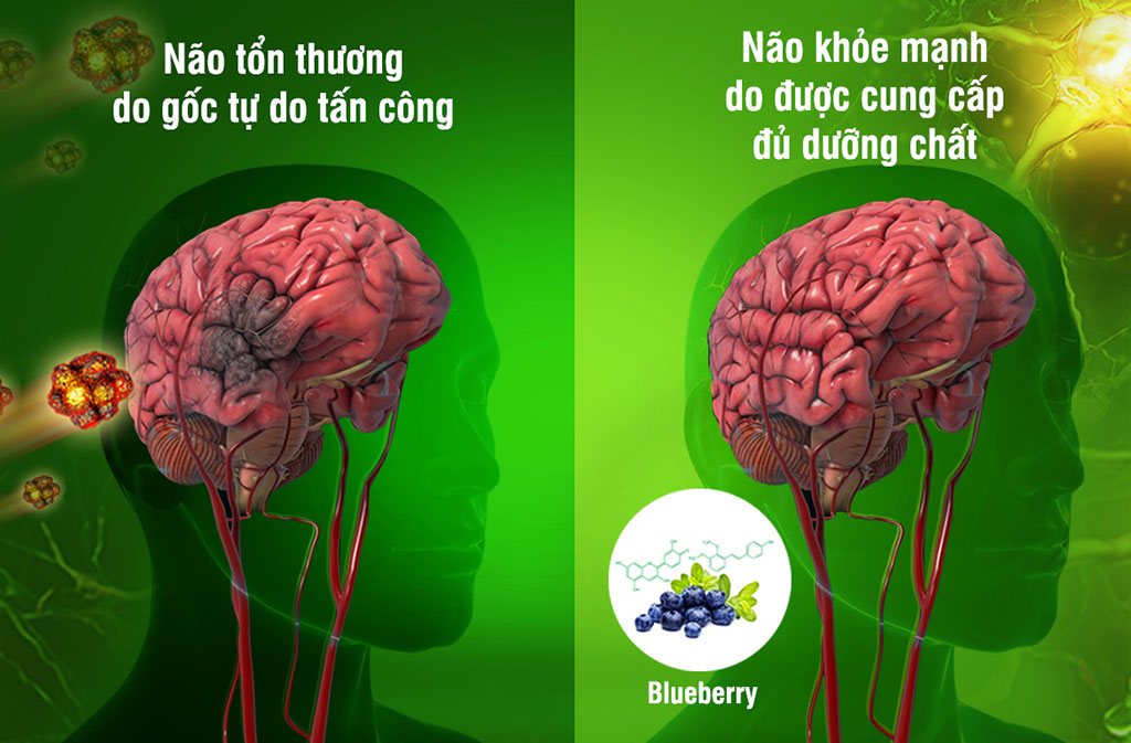 Chủ động chống gốc tự do bằng tinh chất thiên nhiên từ Blueberry có trong OTIV giúp cải thiện hiệu quả đau đầu từ gốc