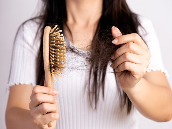 Hệ thống miễn dịch có thể tấn công tóc đến tận gốc và làm hỏng tóc, khiến tóc rụng từng mảng Shutterstock