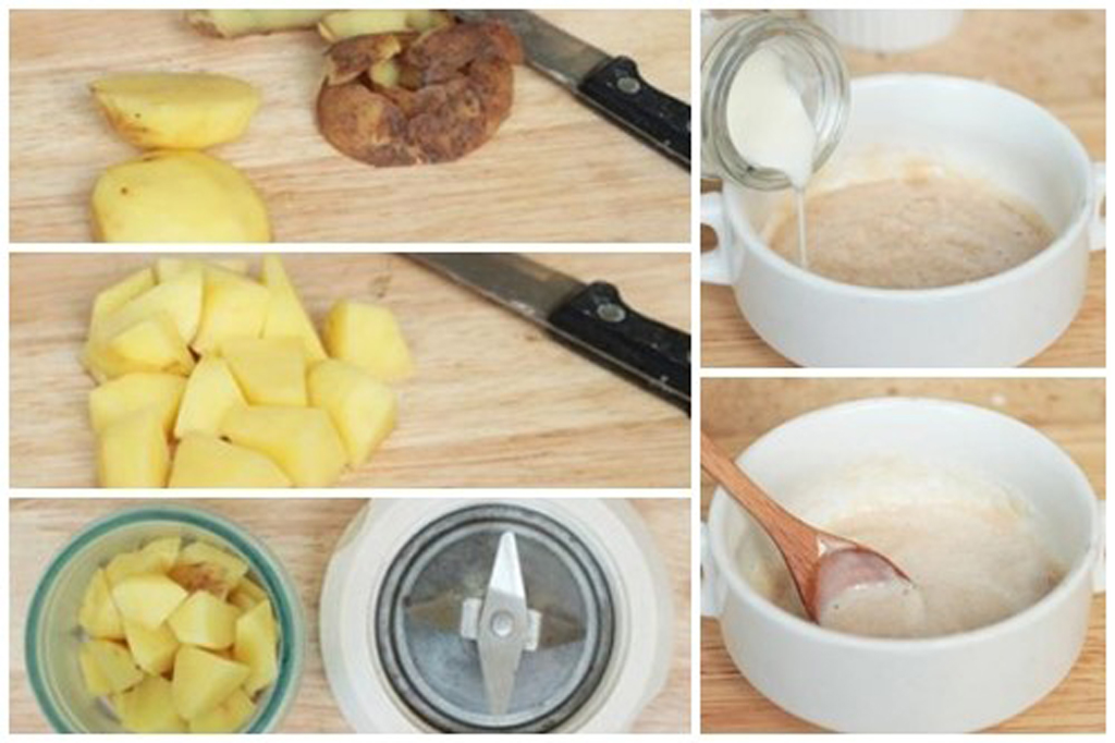 Applying potato mask, combined with fresh milk and aloe vera gel is an effective way to treat dark circles