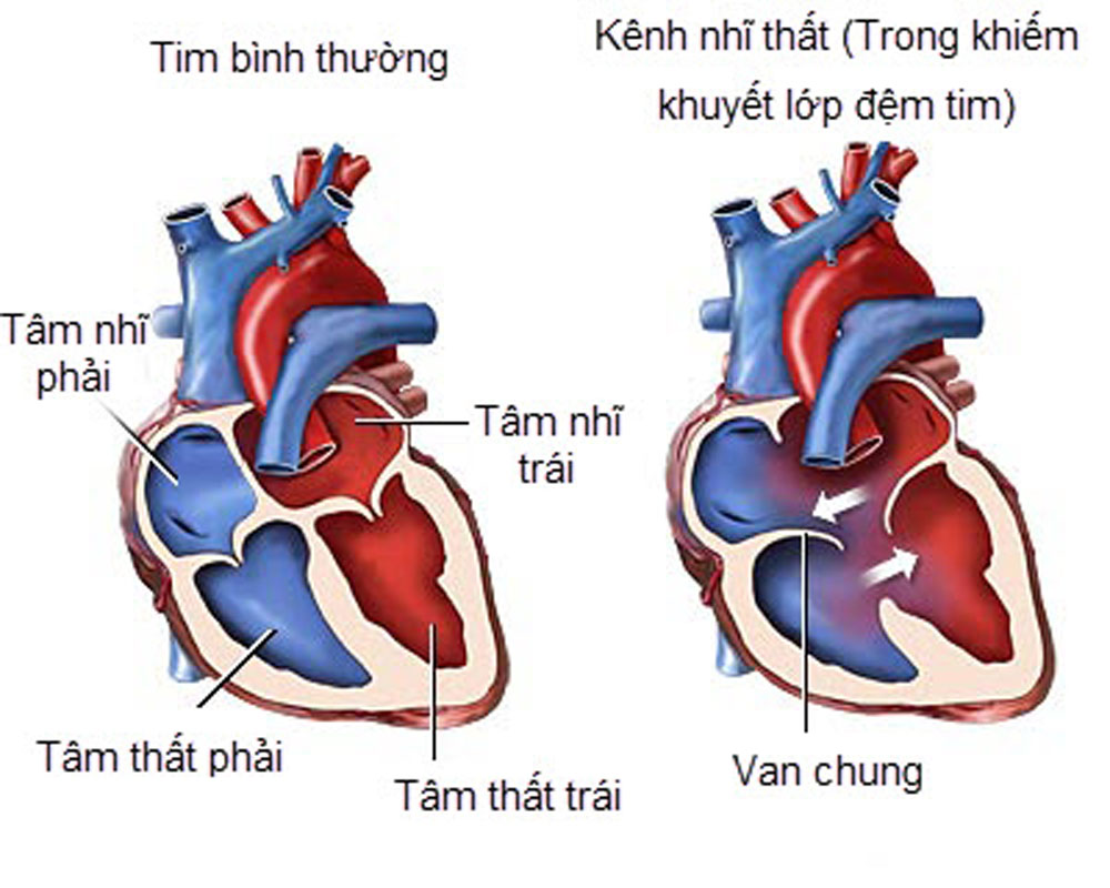 defect-vs-defective-difference-between-defect-and-defective