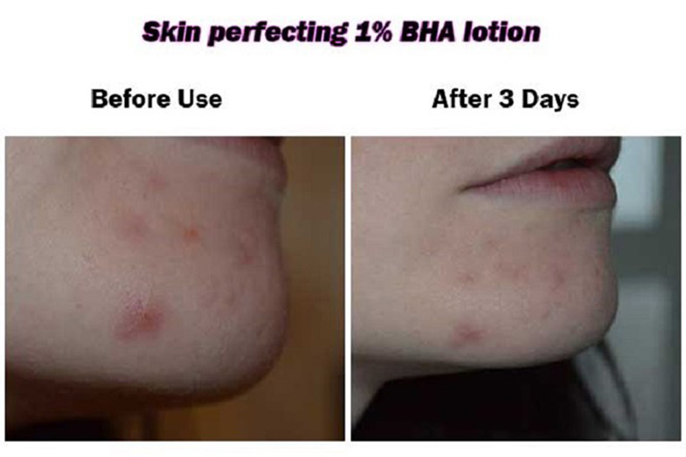 Tẩy tế bào chết chính là chìa khóa giúp bạn sở hữu làn da khỏe đẹp