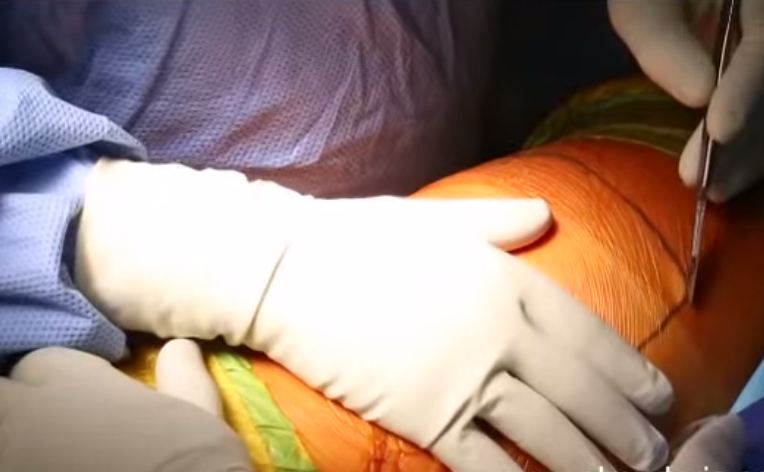 Bệnh viện bị tố cắt bỏ chân bệnh nhân ném vào thùng rác - ảnh 1