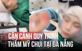 Thẩm mỹ 'chui' bủa vây: Cận cảnh quy trình làm đẹp không phép tại Đà Nẵng
