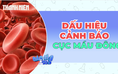 Đừng bỏ qua những dấu hiệu bất thường có thể liên quan đến cục máu đông