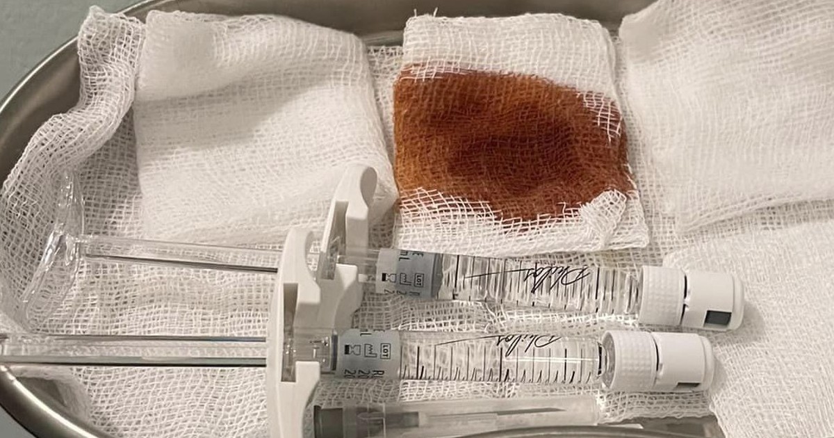 TP.HCM xử phạt thẩm mỹ viện vi phạm