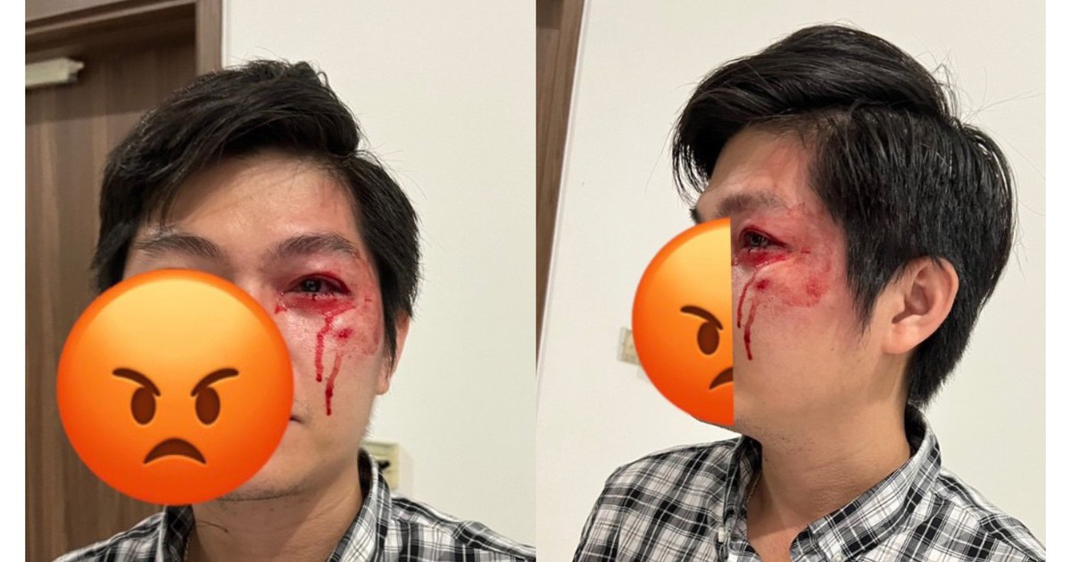 Người cha bị chủ chó đánh ở TP.HCM: Đã đi giám định thương tích, quyết không hòa giải