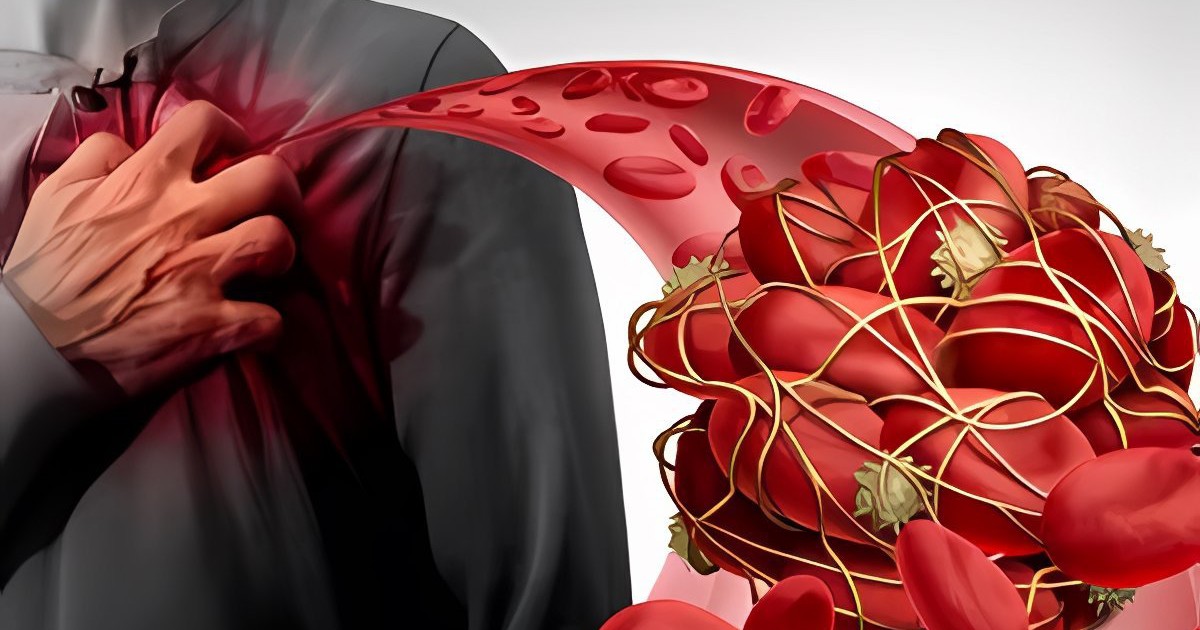 Căn bệnh nguy hiểm khiến người phụ nữ chỉ kịp kêu đau vai rồi 'ra đi'