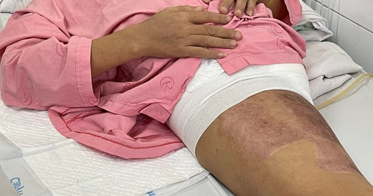 Kỳ tích 112 ngày cứu bệnh nhân bị xe container cán qua người