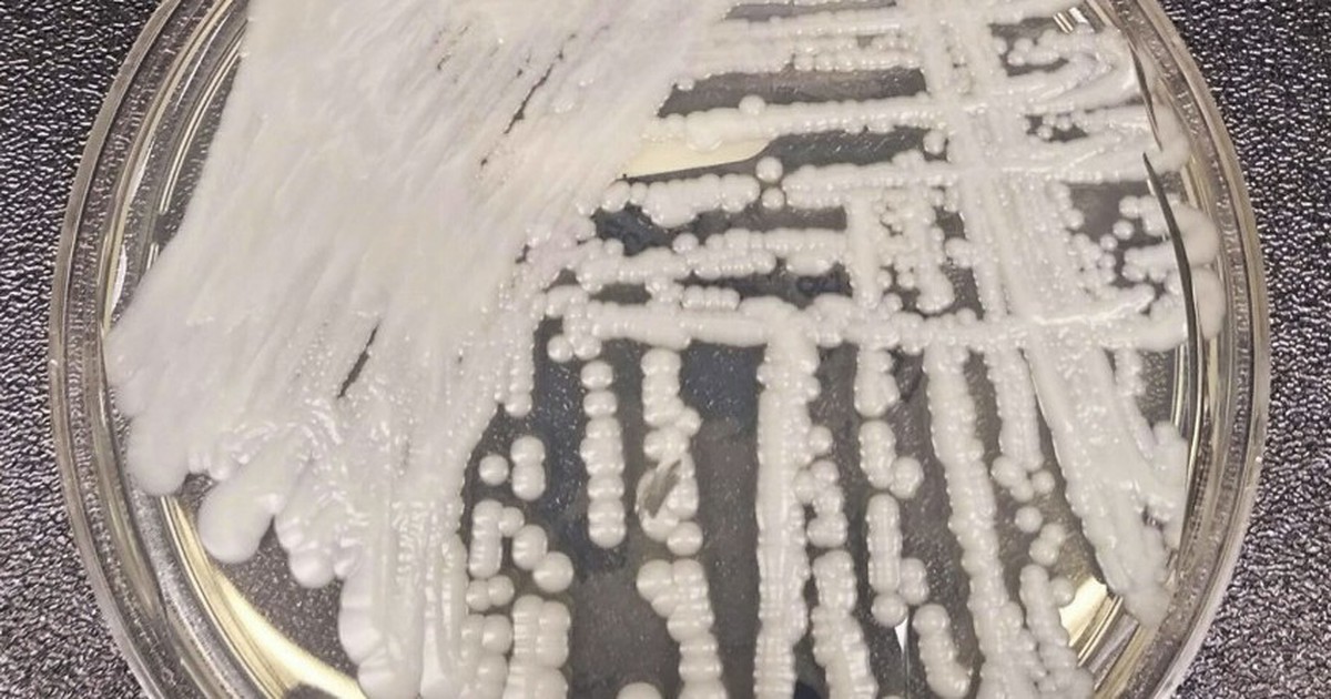 Siêu khuẩn kháng thuốc chết chóc tăng mạnh ở Mỹ trong thời gian dịch Covid-19