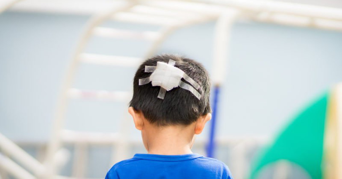 Nhận biết dấu hiệu chấn thương sọ não để cấp cứu kịp thời