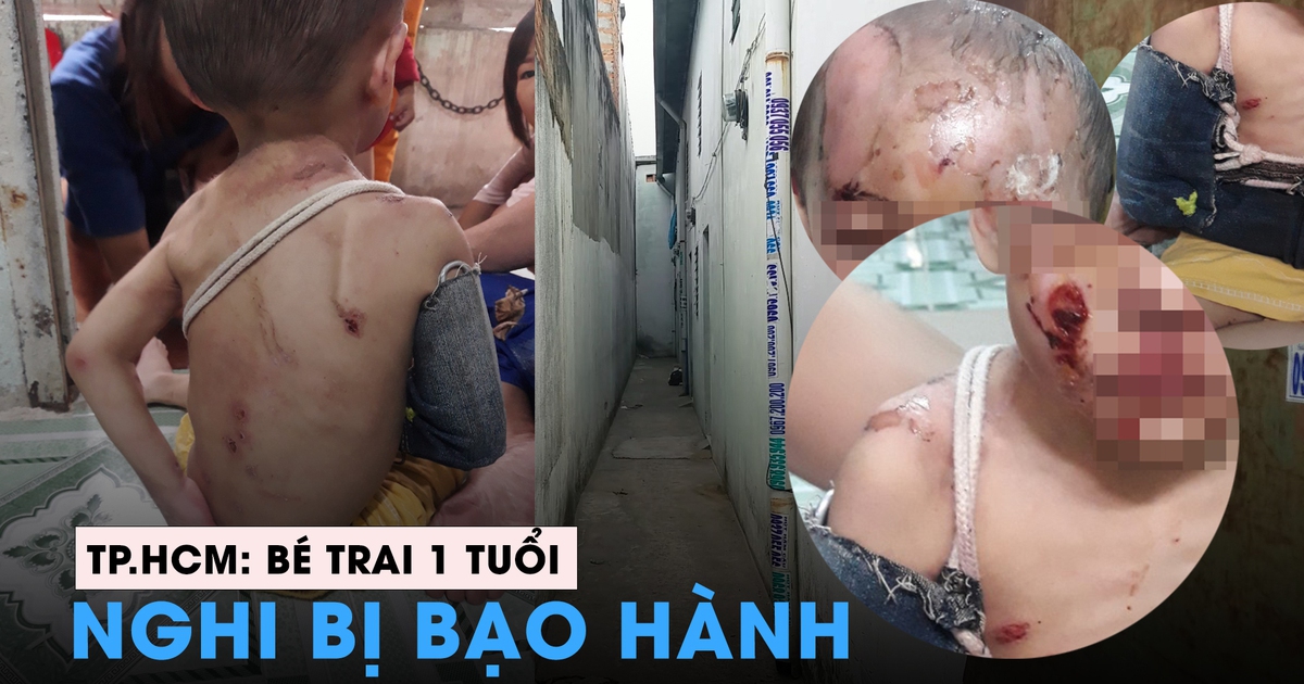 Làm rõ vụ bé trai hơn 1 tuổi nghi bị bạo hành tại TP.HCM