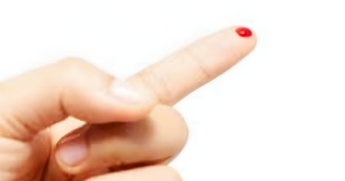 Nguy kịch do chích máu đầu ngón tay, chân để chữa đột quỵ