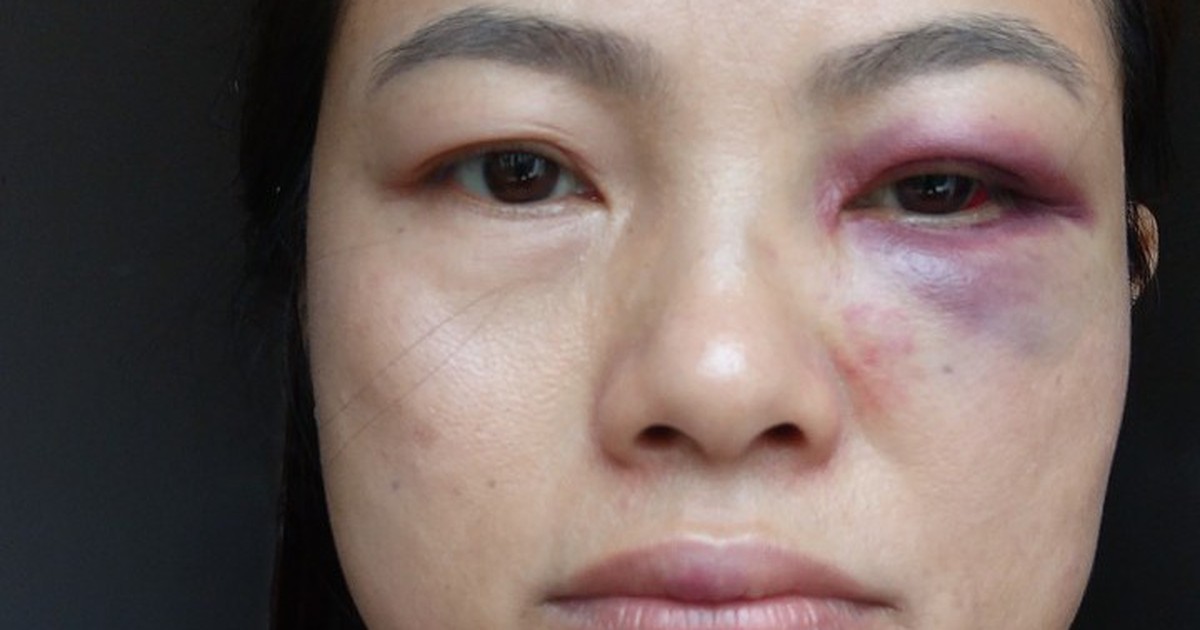 Đồng Nai: Làm rõ thông tin người mẹ cùng 3 con liên tục bị bạo hành