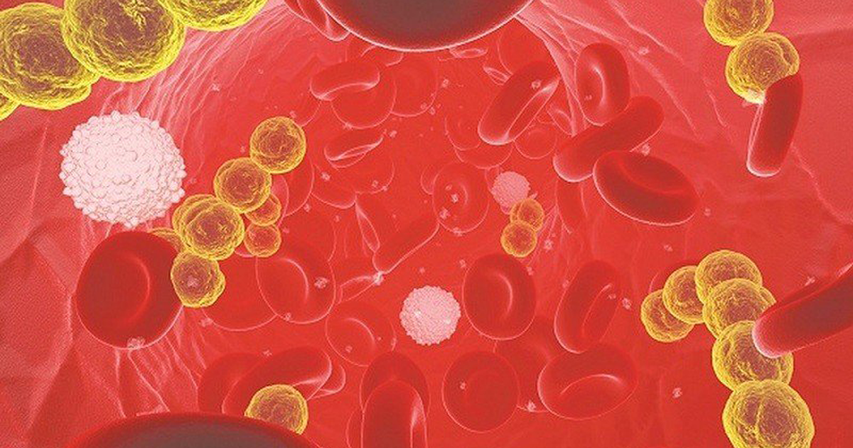 Cứ làm điều này khi đi vệ sinh, rước bệnh hồi nào không hay