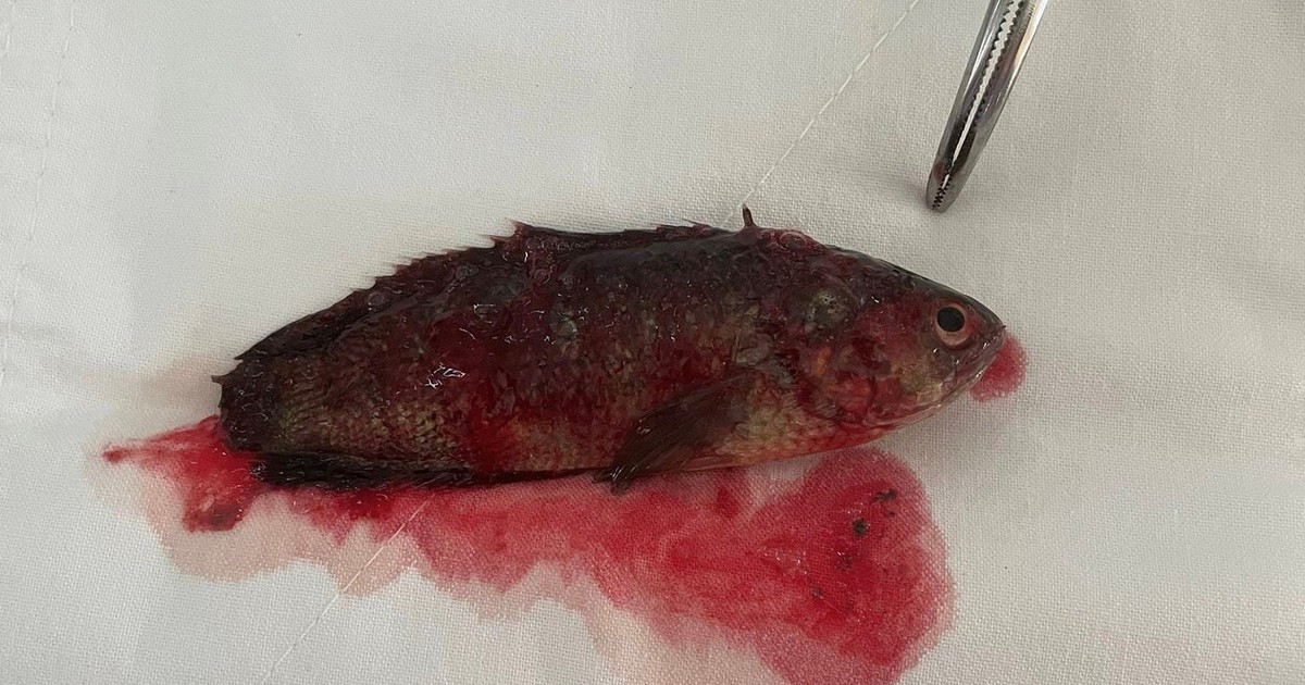 Hy hữu: Bị cá rô chui tọt vào họng trong lúc đi mò cá