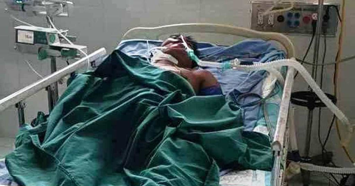 Quảng Nam: Người đàn ông bị ong vò vẽ đốt dẫn đến ngưng tim, ngưng thở