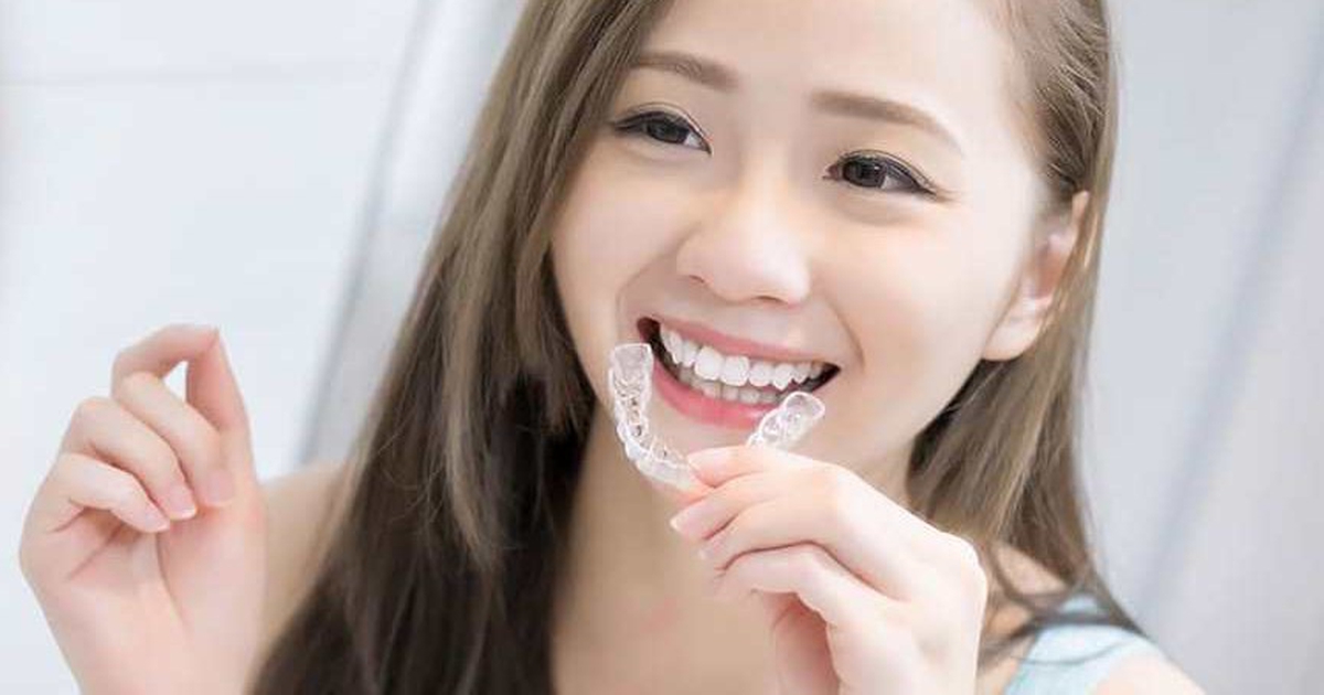 Niềng Răng Invisalign TPHCM: Giải Pháp Chỉnh Nha Hiện Đại Tại Thành Phố Lớn Nhất Việt Nam 4 Những Lưu Ý Khi Niềng Răng Invisalign