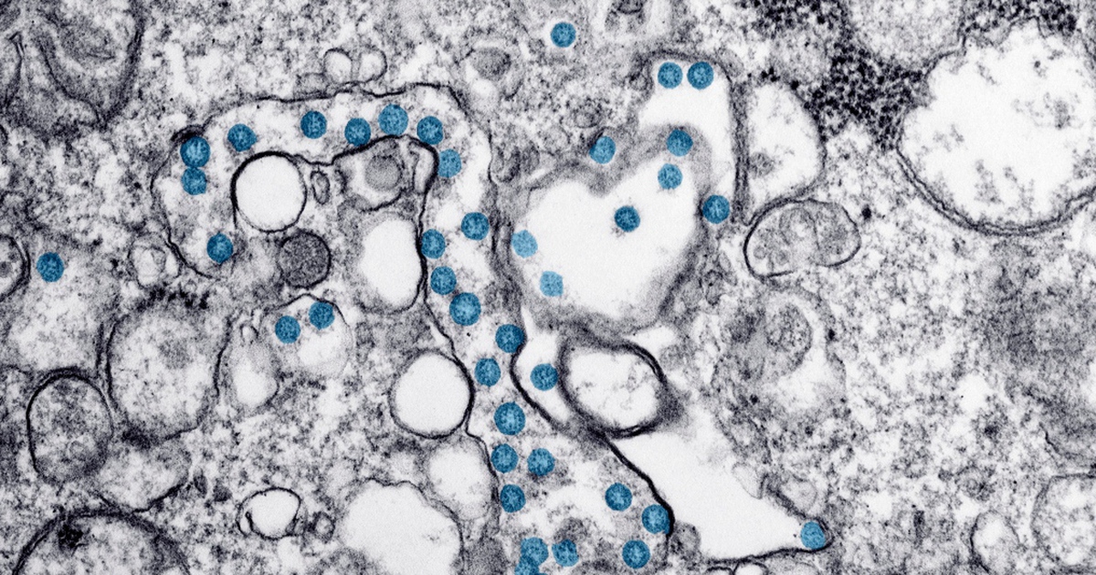 Một biến thể mới gây Covid-19 lây lan nhanh tại nhiều nước