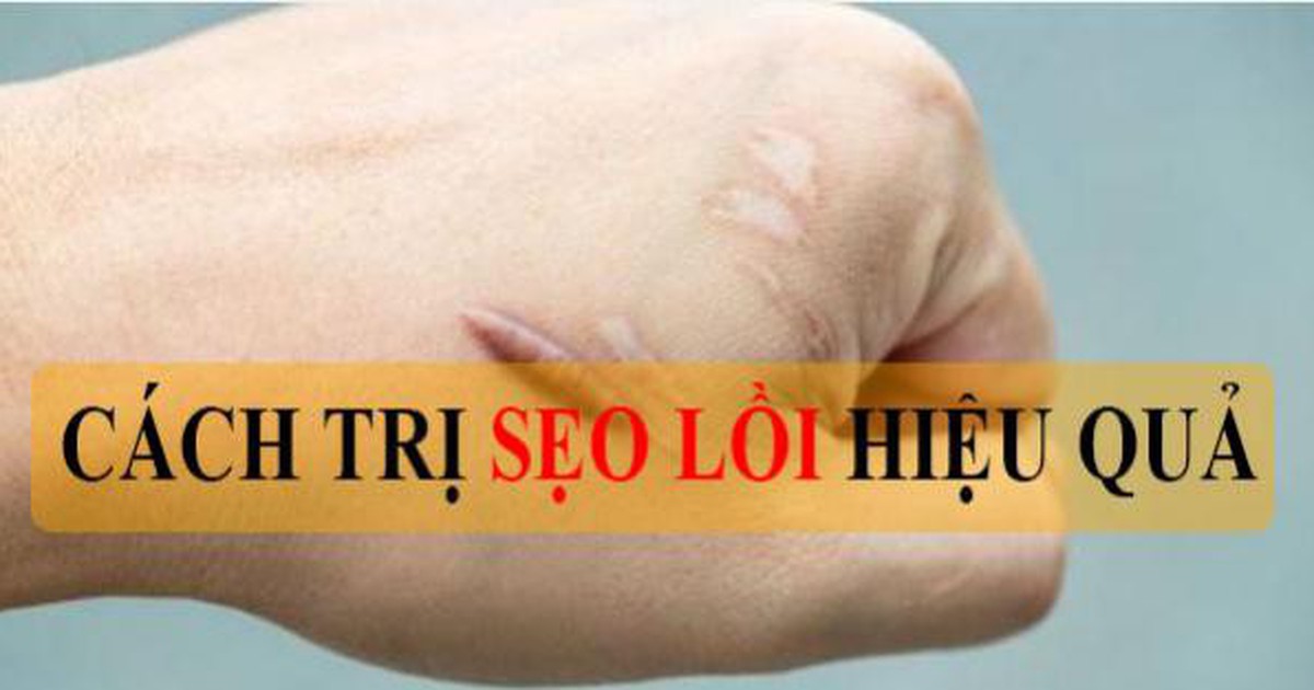 Top 10 cách trị sẹo lồi hiệu quả bất chấp tuổi sẹo