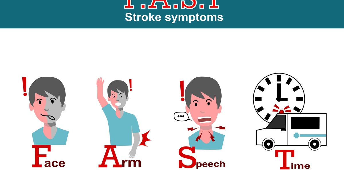 FAST và dấu hiệu nhận biết nguy cơ đột quỵ