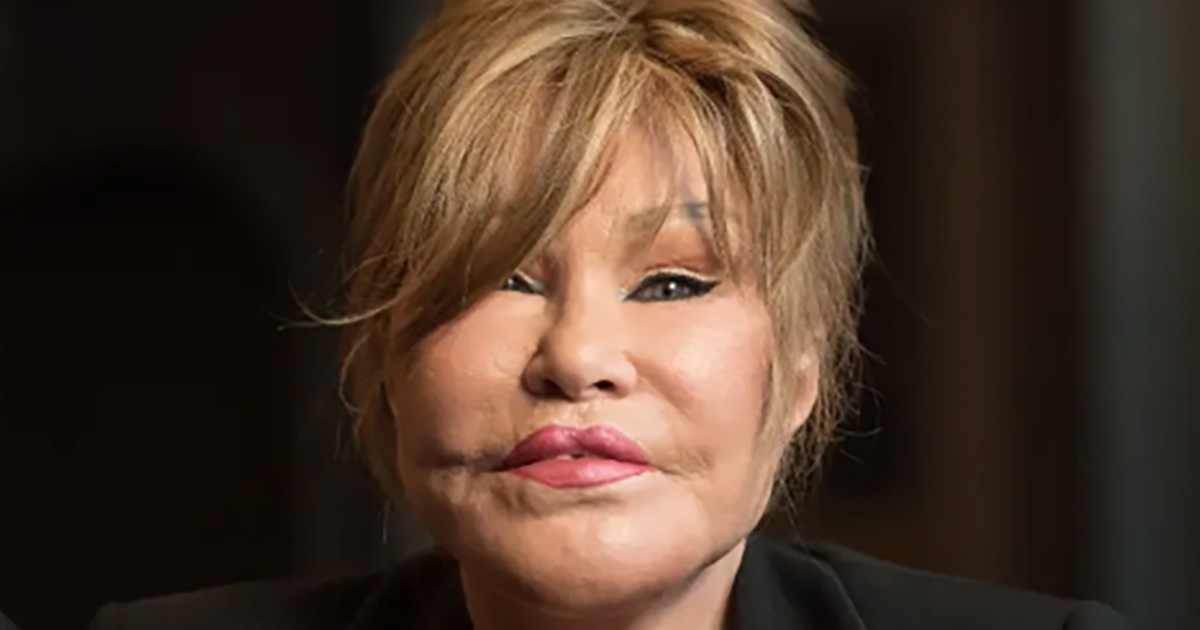 ‘Miêu nữ' Jocelyn Wildenstein gây sốc khi đăng ảnh trước và sau phẫu thuật thẩm mỹ