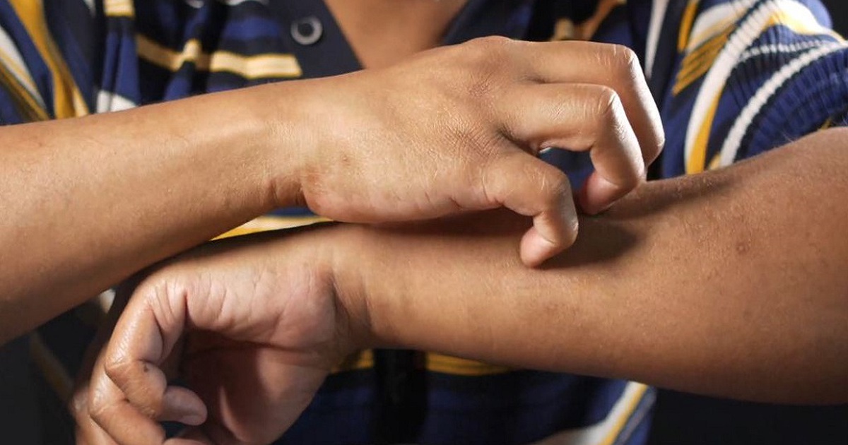 4 dấu hiệu bất ổn cảnh báo ruột đang có vấn đề