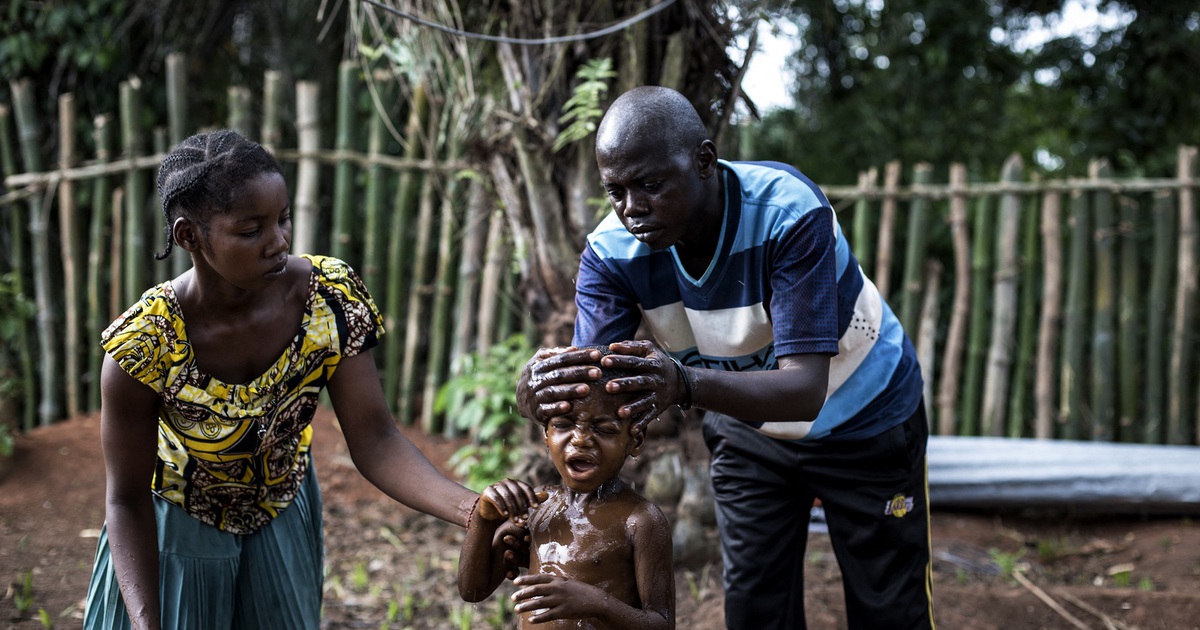 Đã có kết luận về bệnh 'bí ẩn' gây chết người ở Congo
