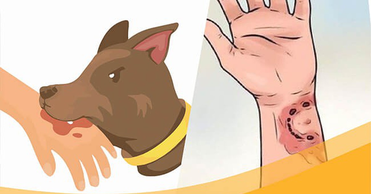 Nguy cơ mắc bệnh dại chực chờ, tuyệt đối không chủ quan khi bị chó, mèo cắn
