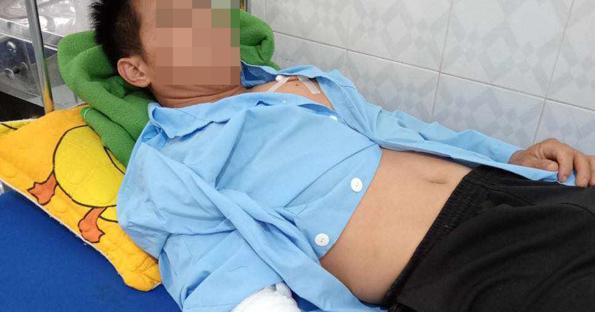 Chủ nuôi bị chó béc giê tấn công phải nhập viện cấp cứu