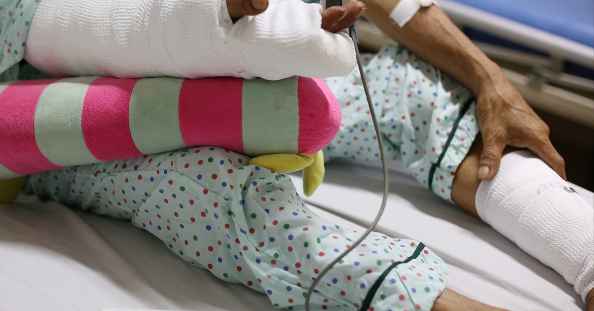 Máy ép nệm cuốn dập nát cánh tay người đàn ông