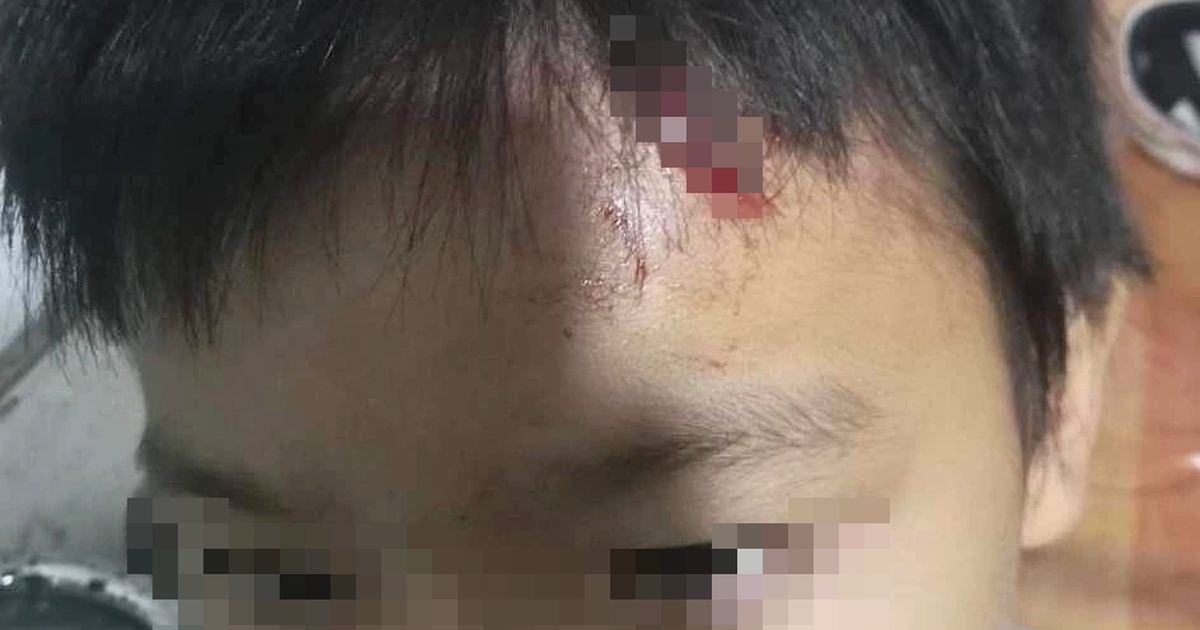 Nghi vấn mẹ kế tái diễn bạo hành con chồng