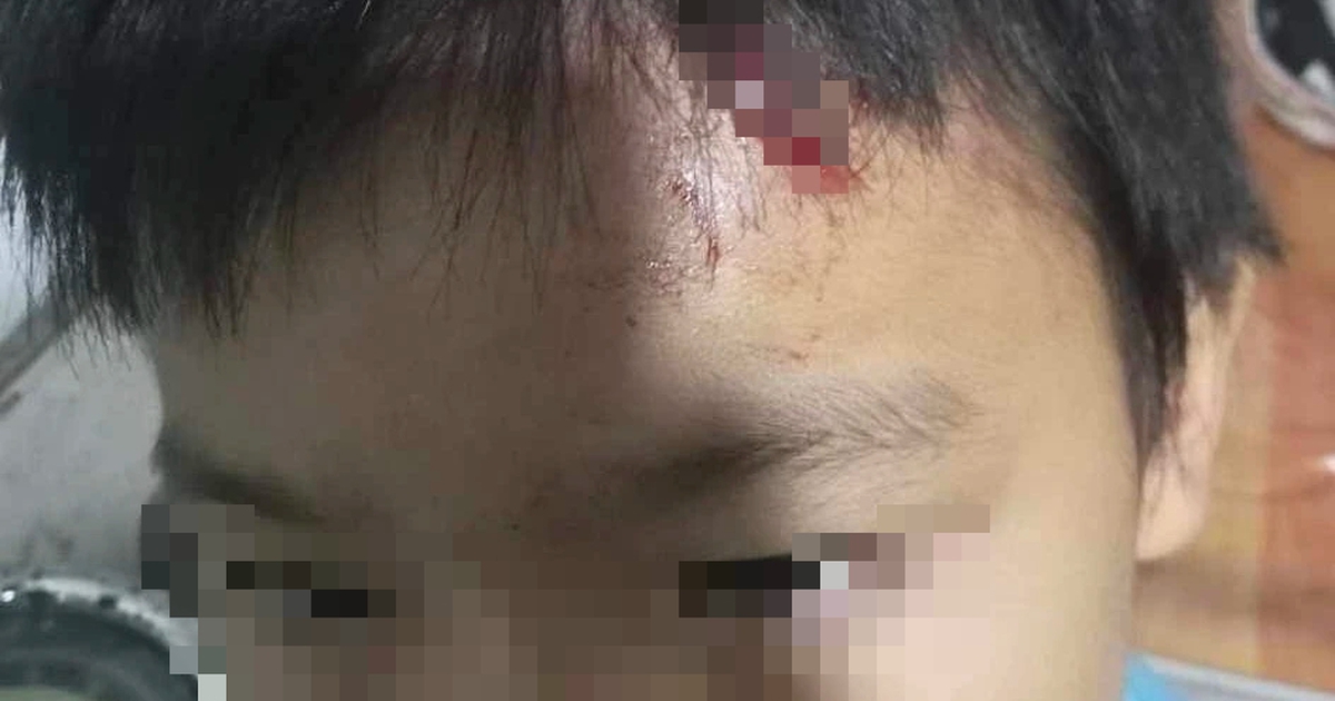 Đưa cháu bé trong vụ nghi bị mẹ kế bạo hành đi khám thương tích