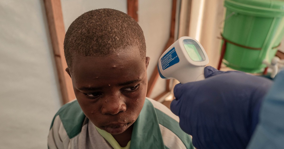 Hàn Quốc tăng cường giám sát đậu mùa khỉ sau cảnh báo của WHO