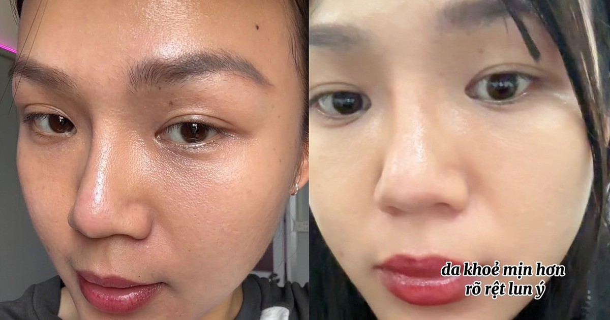 97% phụ nữ bổ sung collagen đúng cách da căng sáng trẻ hơn chục tuổi là thật!