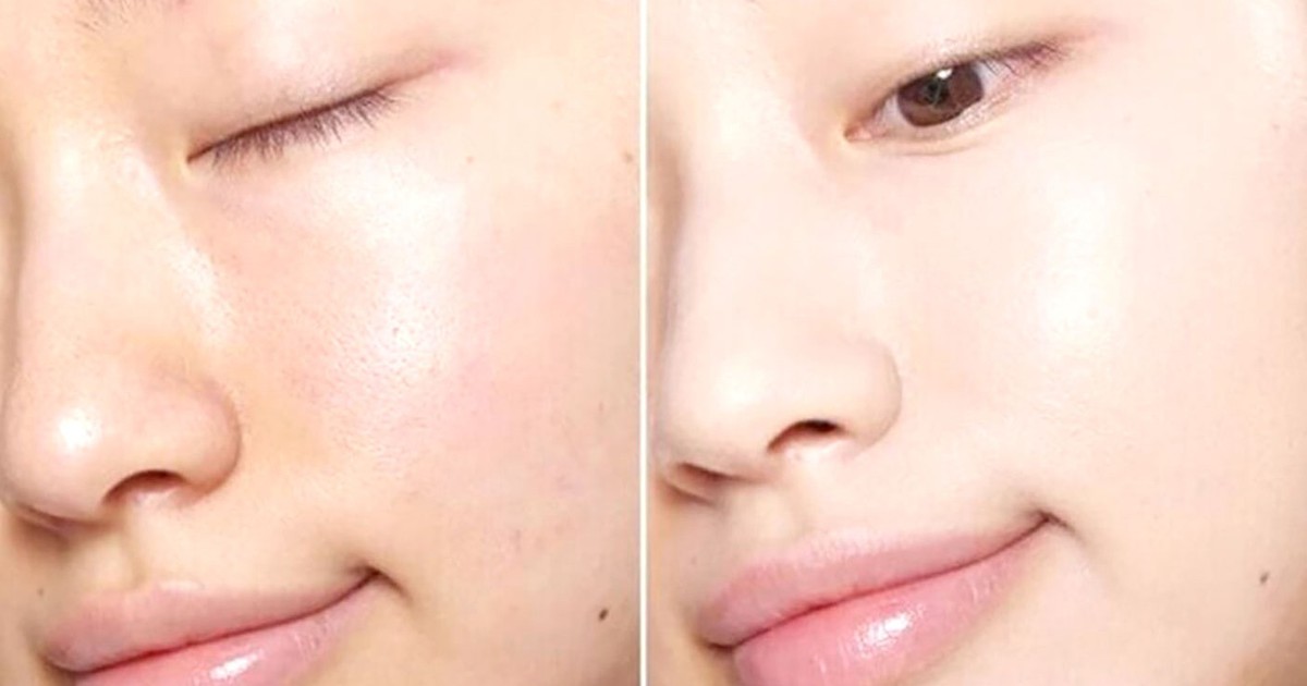 Top 8 serum trắng da đáng tiền từng giọt, mua rồi muốn mua nữa không tiếc tiền