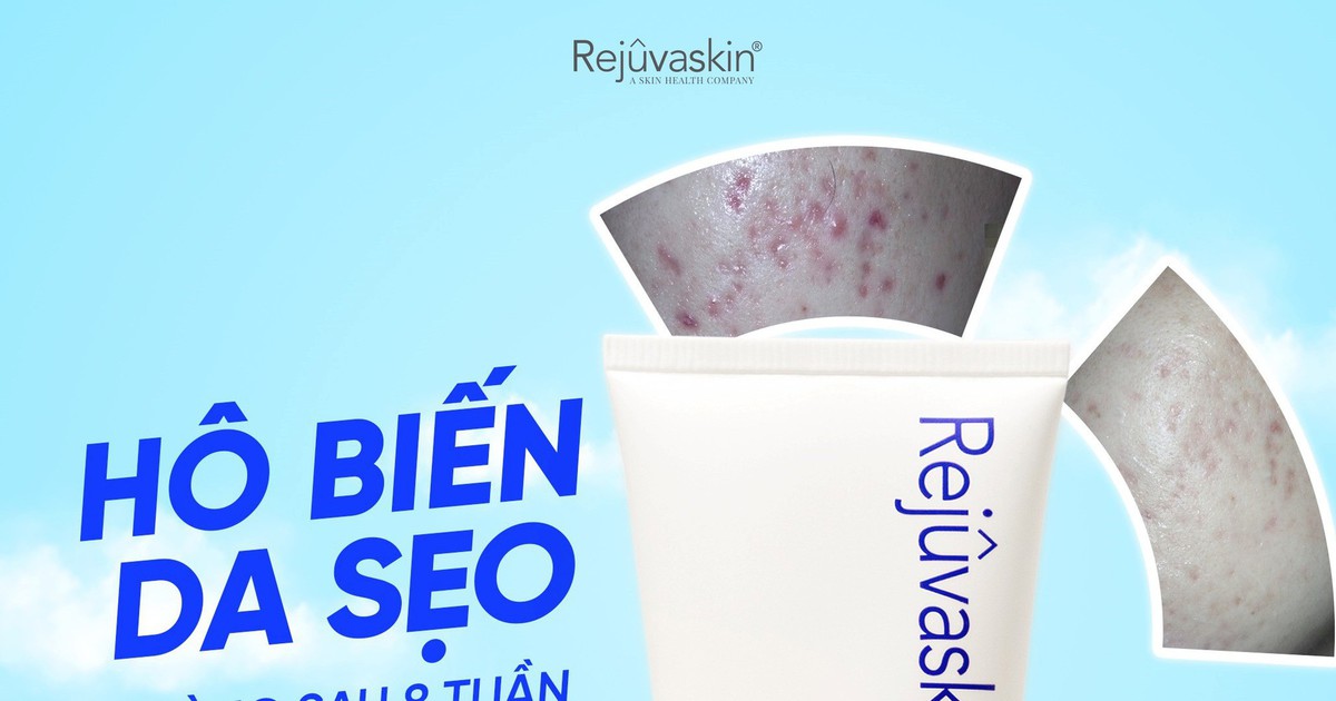 Hướng dẫn sử dụng kem mờ thâm mụn Rejuvaskin Scar Esthetique đúng chuẩn cho da trắng sáng