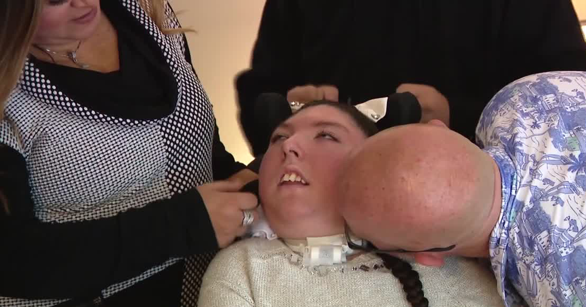 Phép màu cô gái không có não vẫn sống đến 20 tuổi