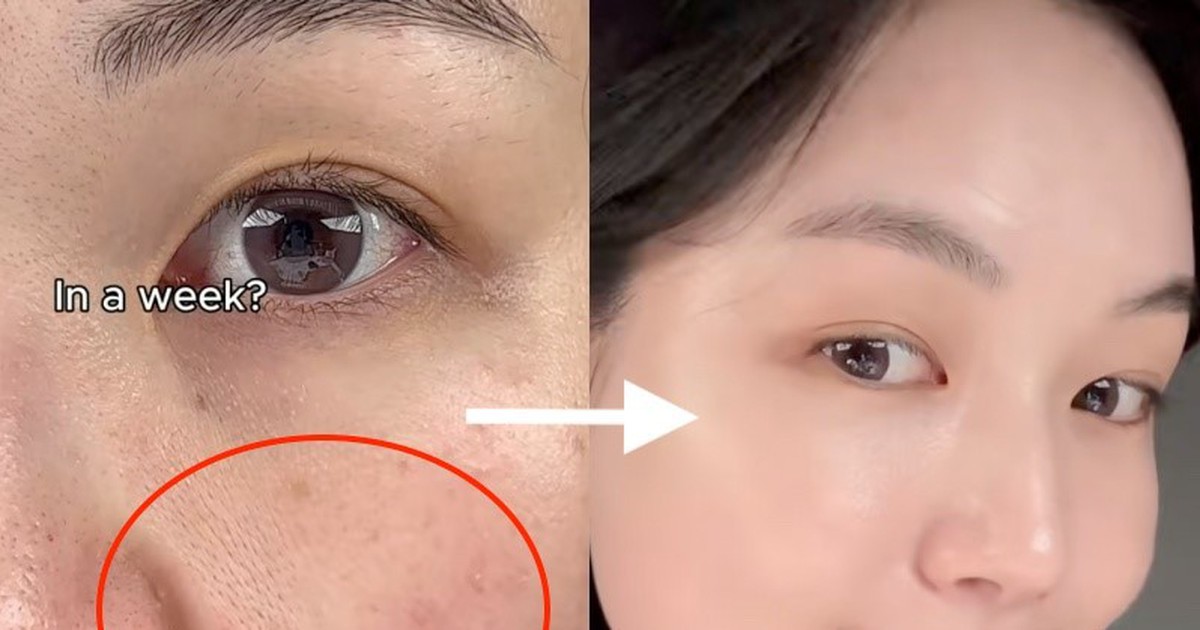 Retinol nào ‘vừa mạnh vừa lành tính’? Top 3 giúp cải thiện nếp nhăn, không bong tróc!