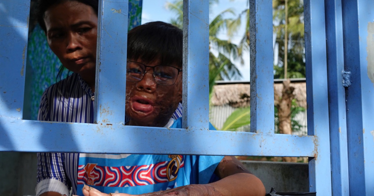 Thanh Ni&ecirc;n v&agrave; t&ocirc;i: T&ocirc;i đ&atilde; chứng kiến 'ph&eacute;p m&agrave;u' từ Thanh Ni&ecirc;n