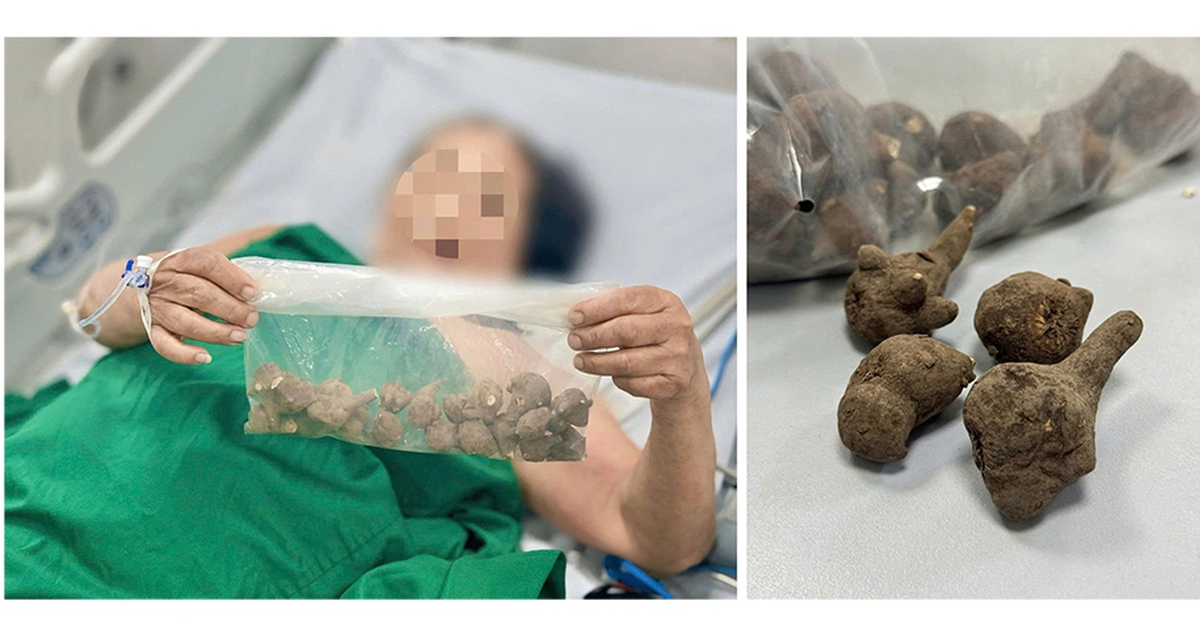 Nguy kịch do uống nước củ ấu tầu trị đau khớp