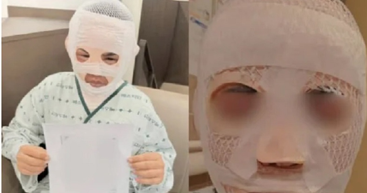 Một người chồng H&agrave;n Quốc tạt nước s&ocirc;i v&agrave;o mặt vợ người Th&aacute;i Lan