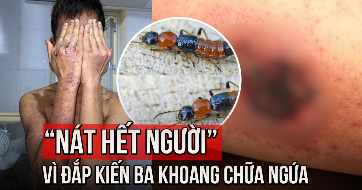 Đắp kiến ba khoang chữa ngứa, nam thanh niên tổn thương da toàn thân