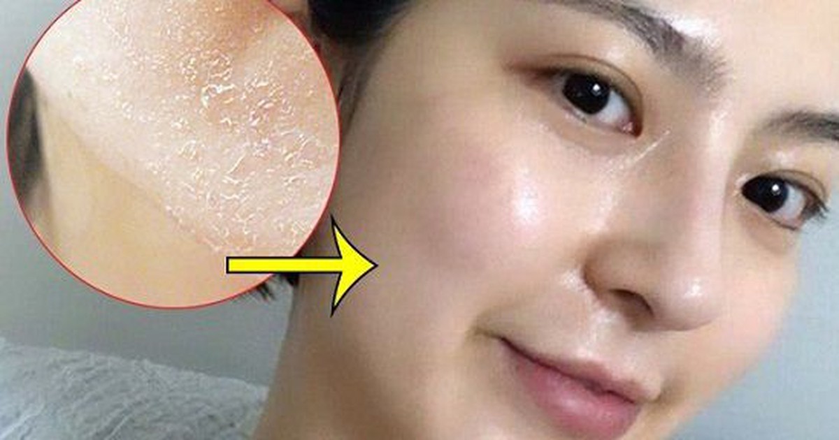 Phục hồi da sau peel chuẩn y khoa chỉ 7 ngày da khỏe đẹp, rạng ngời